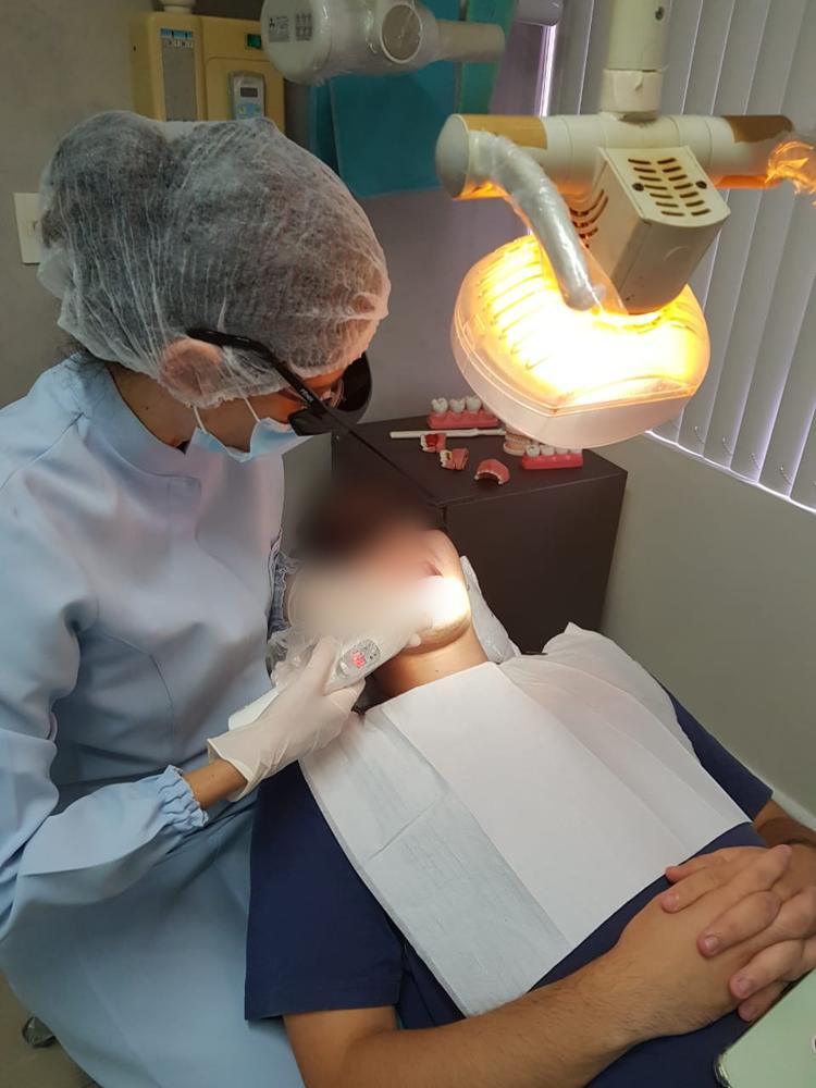 Laserterapia no tratamento do herpes labial