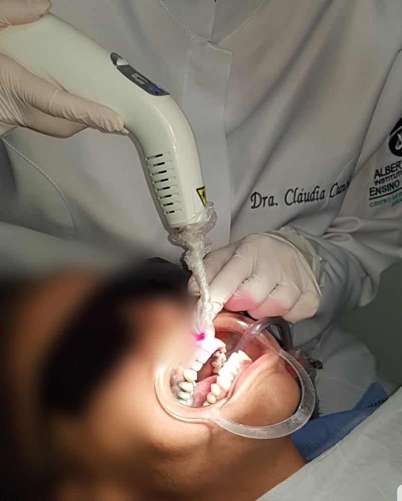 Laserterapia no tratamento da doença periodontal